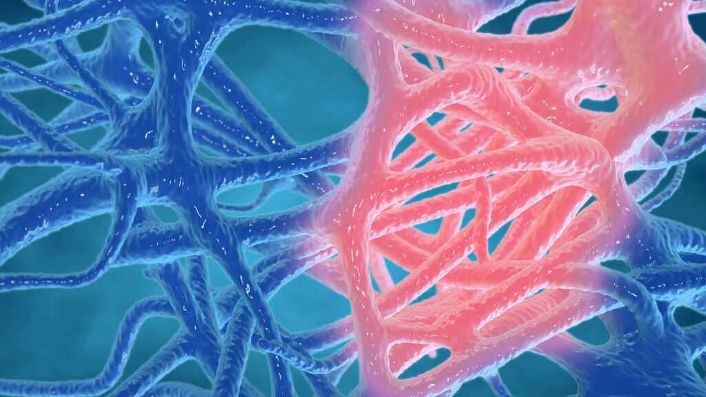 Inflammation